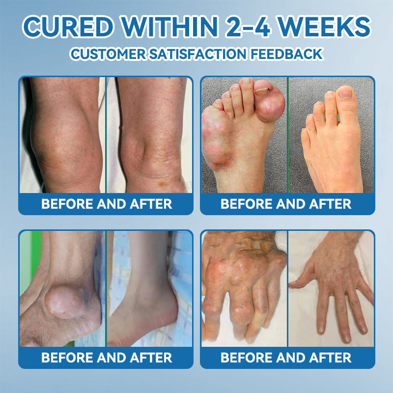 🇦🇺🫒shinneey™𝐁𝐏𝐂-𝟏𝟓𝟕 𝐉𝐨𝐢𝐧𝐭 𝐇𝐞𝐚𝐥𝐢𝐧𝐠 𝐂𝐫𝐞𝐚𝐦🦴Treats Arthritis, Neuropathy, Rheumatism, Sports Injuries & More🏆