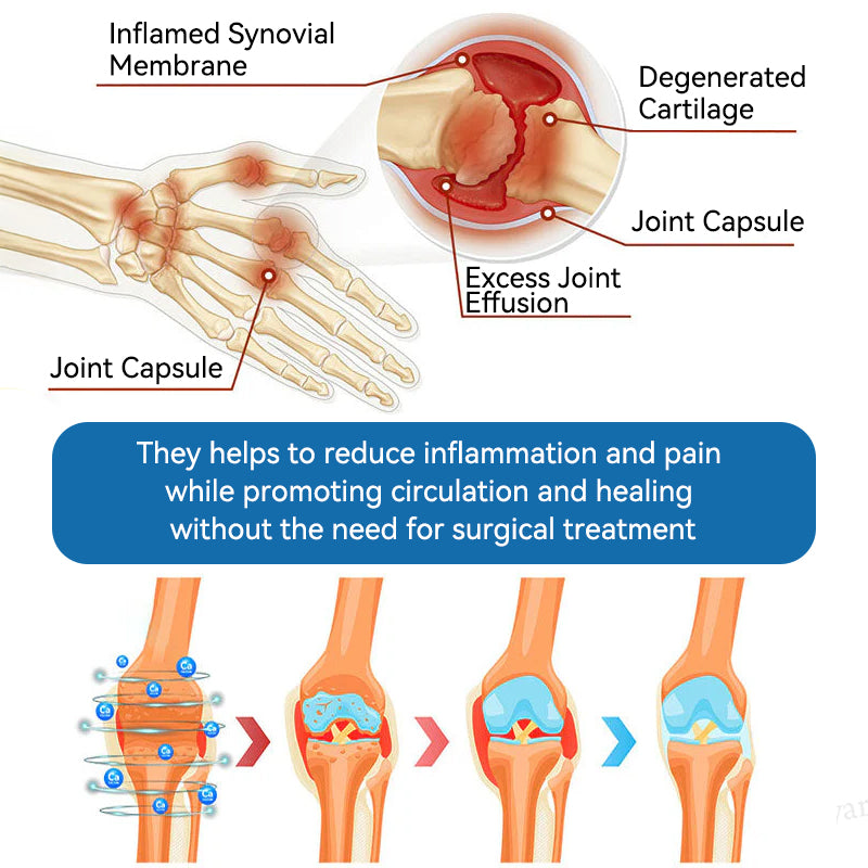 🇦🇺🫒shinneey™𝐁𝐏𝐂-𝟏𝟓𝟕 𝐉𝐨𝐢𝐧𝐭 𝐇𝐞𝐚𝐥𝐢𝐧𝐠 𝐂𝐫𝐞𝐚𝐦🦴Treats Arthritis, Neuropathy, Rheumatism, Sports Injuries & More🏆