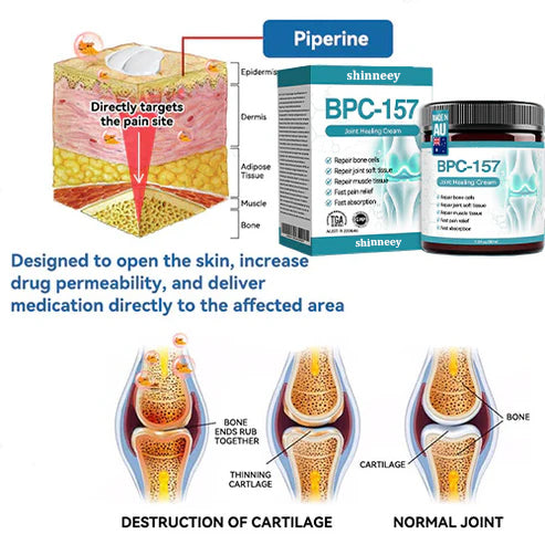 🇦🇺🫒shinneey™𝐁𝐏𝐂-𝟏𝟓𝟕 𝐉𝐨𝐢𝐧𝐭 𝐇𝐞𝐚𝐥𝐢𝐧𝐠 𝐂𝐫𝐞𝐚𝐦🦴Treats Arthritis, Neuropathy, Rheumatism, Sports Injuries & More🏆
