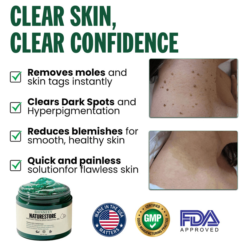 SHINNEEY® NATURESTORE Instant Mole & Spot Gel