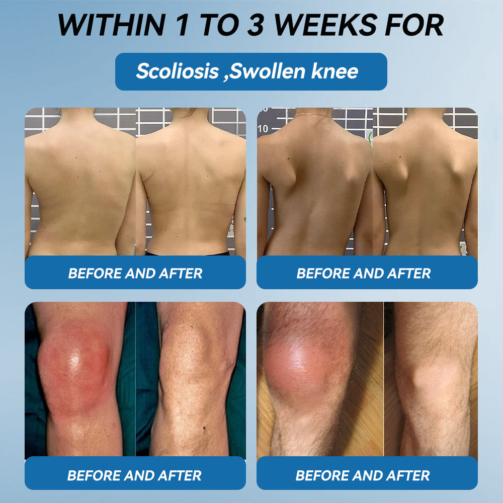 🇦🇺🫒shinneey™𝐁𝐏𝐂-𝟏𝟓𝟕 𝐉𝐨𝐢𝐧𝐭 𝐇𝐞𝐚𝐥𝐢𝐧𝐠 𝐂𝐫𝐞𝐚𝐦🦴Treats Arthritis, Neuropathy, Rheumatism, Sports Injuries & More🏆
