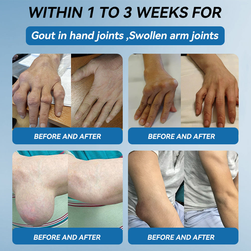 🇦🇺🫒shinneey™𝐁𝐏𝐂-𝟏𝟓𝟕 𝐉𝐨𝐢𝐧𝐭 𝐇𝐞𝐚𝐥𝐢𝐧𝐠 𝐂𝐫𝐞𝐚𝐦🦴Treats Arthritis, Neuropathy, Rheumatism, Sports Injuries & More🏆