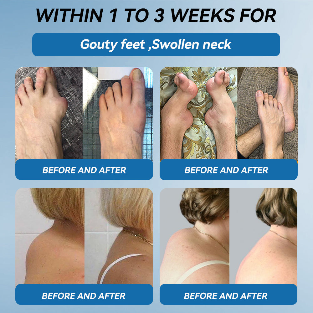 🇦🇺🫒shinneey™𝐁𝐏𝐂-𝟏𝟓𝟕 𝐉𝐨𝐢𝐧𝐭 𝐇𝐞𝐚𝐥𝐢𝐧𝐠 𝐂𝐫𝐞𝐚𝐦🦴Treats Arthritis, Neuropathy, Rheumatism, Sports Injuries & More🏆