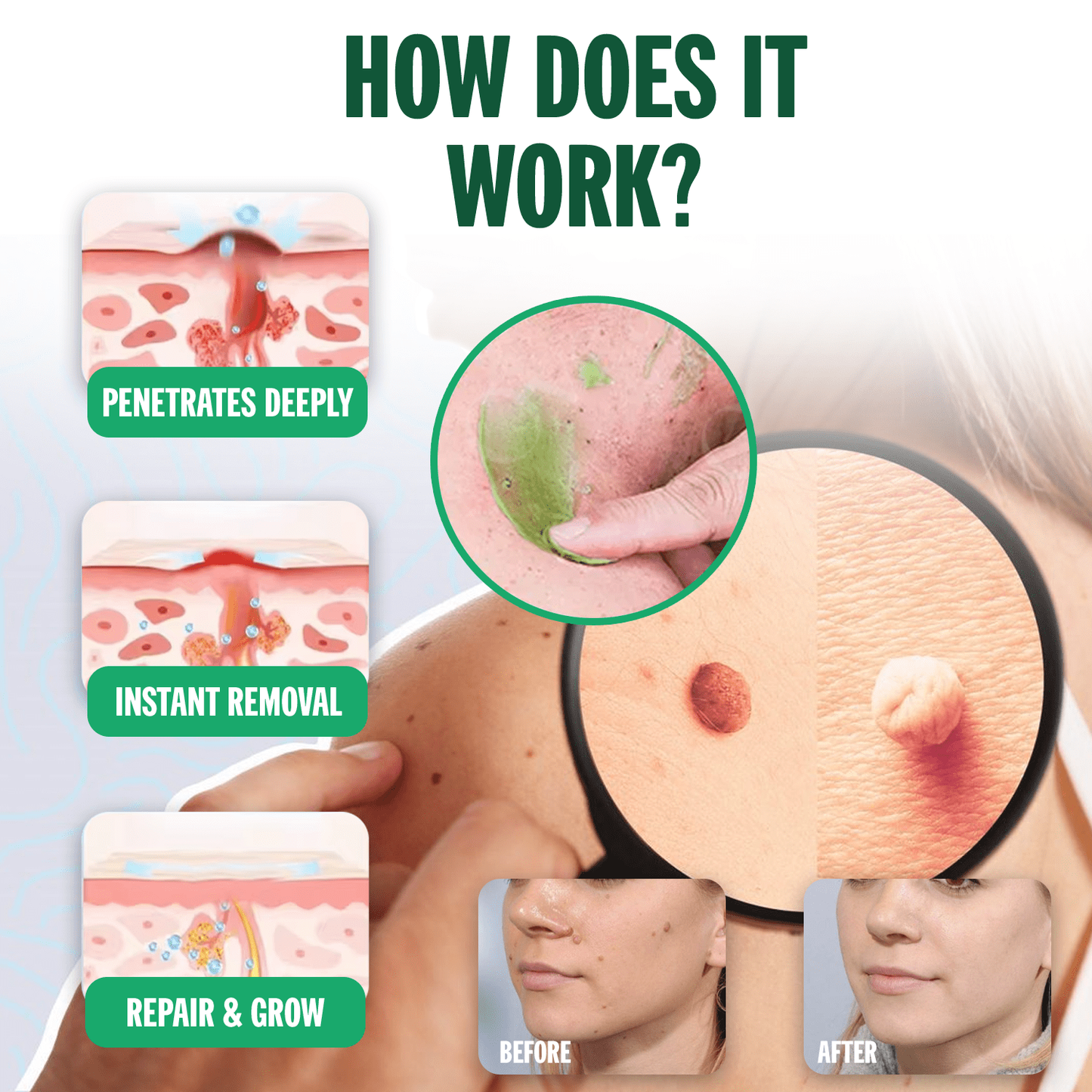 SHINNEEY® NATURESTORE Instant Mole & Spot Gel