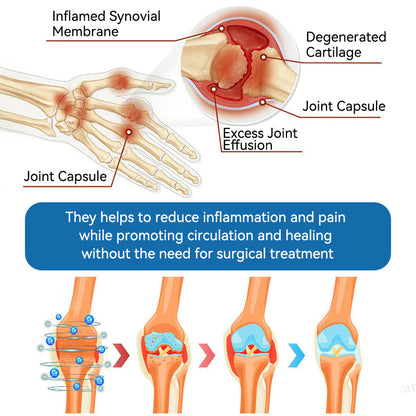 🇦🇺🫒shinneey™𝐁𝐏𝐂-𝟏𝟓𝟕 𝐉𝐨𝐢𝐧𝐭 𝐇𝐞𝐚𝐥𝐢𝐧𝐠 𝐂𝐫𝐞𝐚𝐦🦴Treats Arthritis, Neuropathy, Rheumatism, Sports Injuries & More🏆
