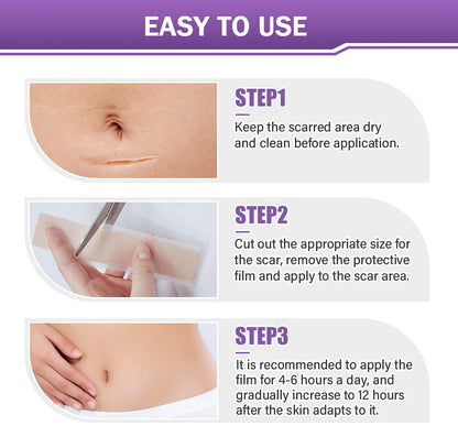 ✅Official Store |shinneey® Hyaluronic Acid Nano Microneedle Repair Tape🏥(Treatment of old and new scars, reduction of surgical scars, stretch marks, keloids, acne, burns, warts, dermatomes and varicose veins)