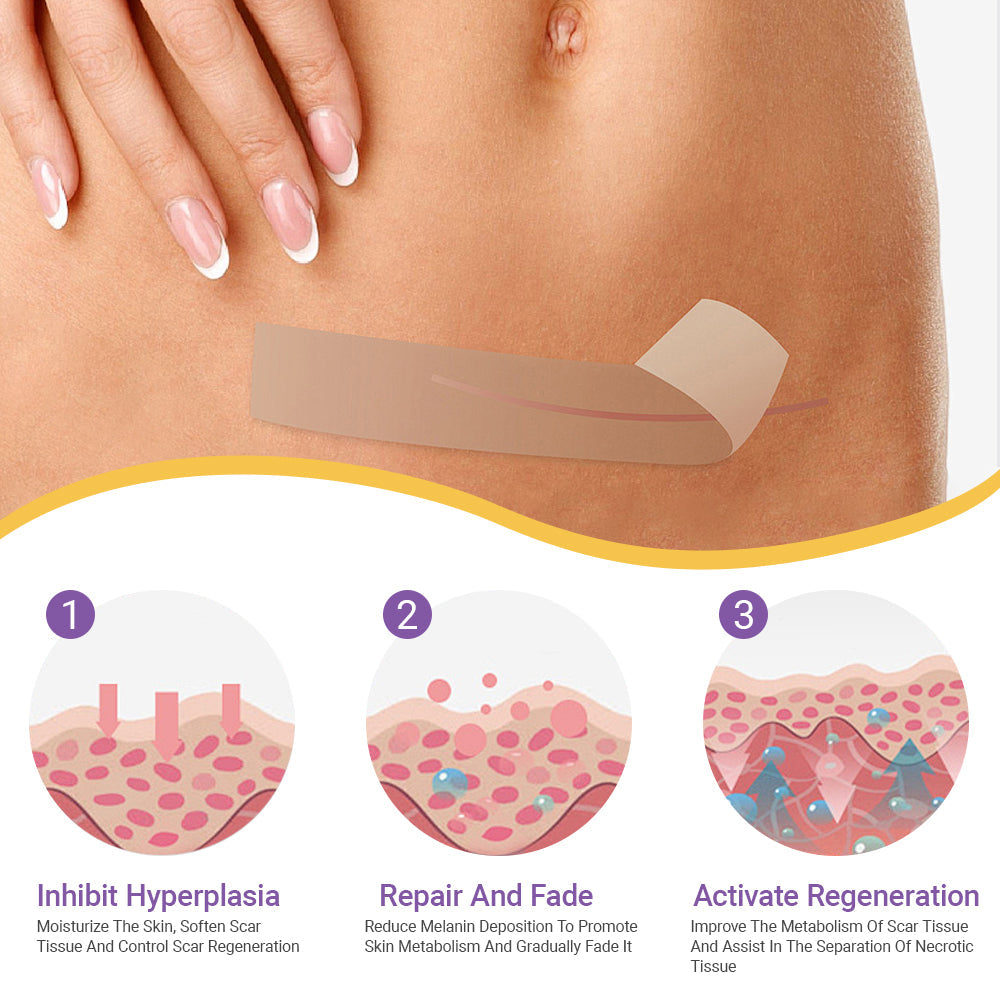✅Official Store |shinneey® Hyaluronic Acid Nano Microneedle Repair Tape🏥(Treatment of old and new scars, reduction of surgical scars, stretch marks, keloids, acne, burns, warts, dermatomes and varicose veins)