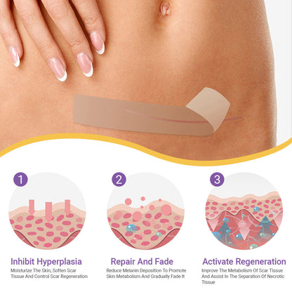 ✅Official Store |shinneey® Hyaluronic Acid Nano Microneedle Repair Tape🏥(Treatment of old and new scars, reduction of surgical scars, stretch marks, keloids, acne, burns, warts, dermatomes and varicose veins)