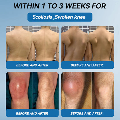 🇦🇺🫒shinneey™𝐁𝐏𝐂-𝟏𝟓𝟕 𝐉𝐨𝐢𝐧𝐭 𝐇𝐞𝐚𝐥𝐢𝐧𝐠 𝐂𝐫𝐞𝐚𝐦🦴Treats Arthritis, Neuropathy, Rheumatism, Sports Injuries & More🏆